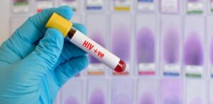 49 cases of Covid-19 among HIV patients in Karnataka, 5 died